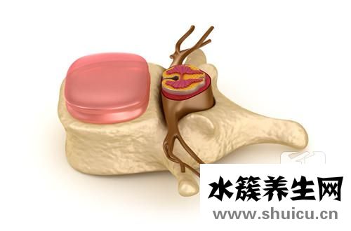 海扶刀手术