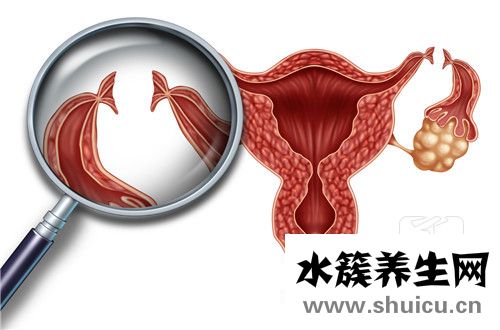 热敷对输卵管有作用吗？输卵管不通，热敷起作用吗？