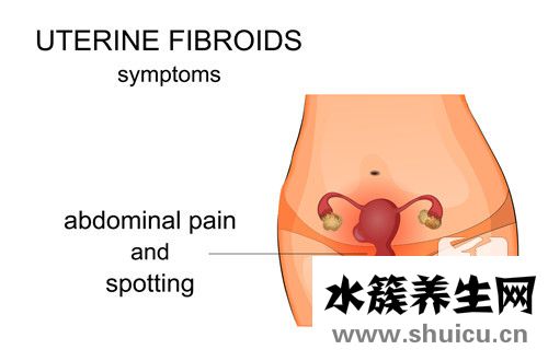 子宫息肉手术多少钱