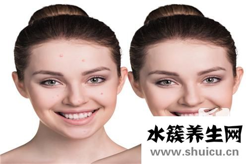 毛囊炎吃什么药最有效