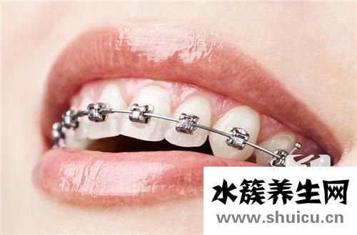 金属牙套的危害有什么？这些影响要警惕！