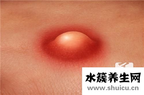 鼻子长