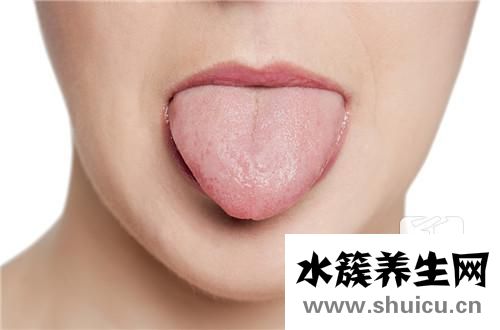 舌苔黄腻最快处理办法