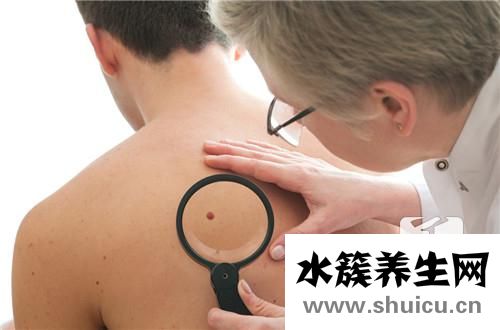 肌肉纤维瘤应该怎样治疗呢？如何治疗恶性肌肉纤维瘤