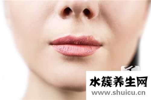 嘴角裂了办