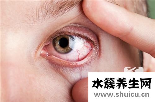 贝立凯护眼仪