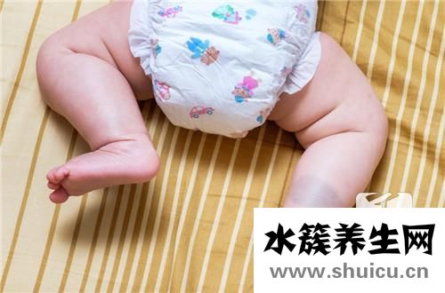 能去掉胎记