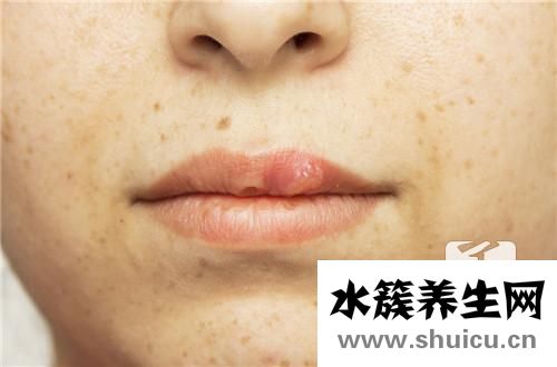 毒疙瘩