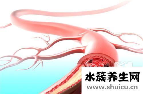 血管彩超能检查出什么？彩超能检查出什么