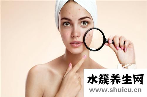 闭口和痘痘的区别是什么？闭口粉刺和痘痘的区别