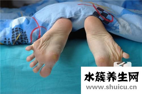 脚趾缝脱皮发痒怎么办？脚趾缝脱皮发痒是什么引起的