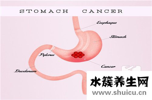 肝气犯胃最佳治疗方剂？肝气犯胃的中医治法有哪些？