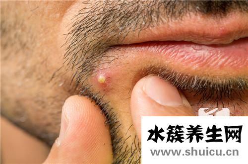带状疱疹后续治疗