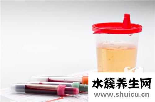 马桶里尿垢去除