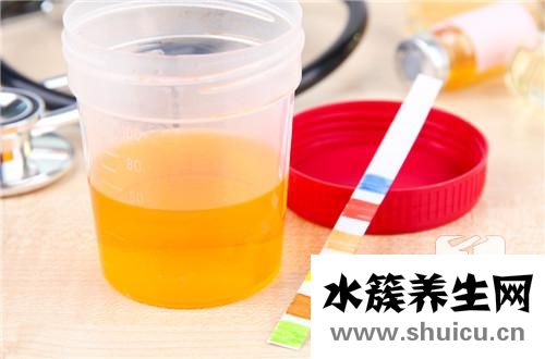 反常性酸性尿