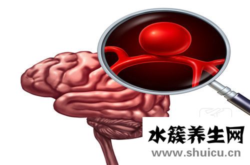 脑组织