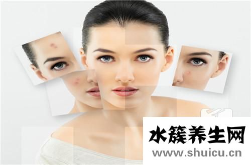 鼻子下面长白色的脓包？鼻子附近一直长白色的小脓包