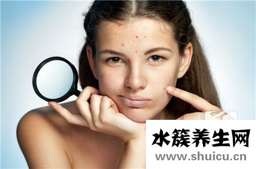 中医内调排毒祛痘的方法有哪些？排毒祛痘的好方法