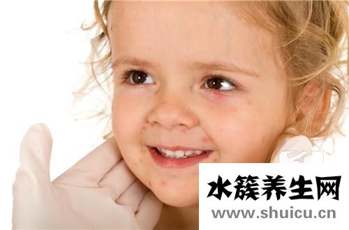 脸上小包不痛不痒凸起