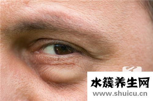 脸上小包不痛不痒凸起
