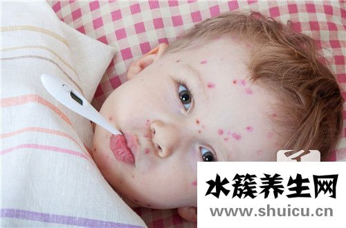 水痘传播途径