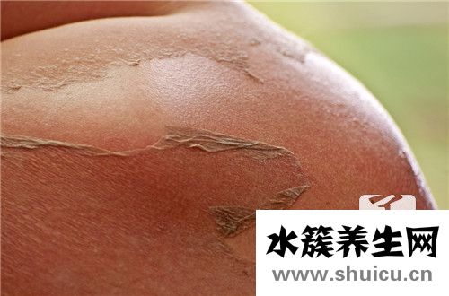 淤血斑