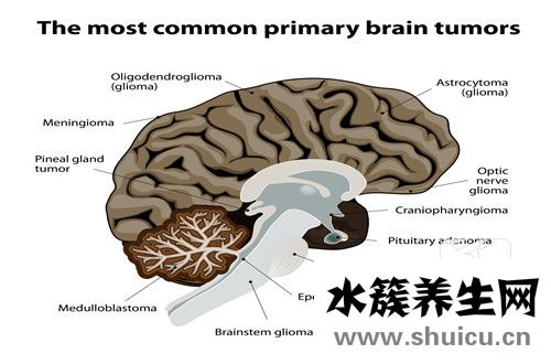 神经纤维瘤能治好吗
