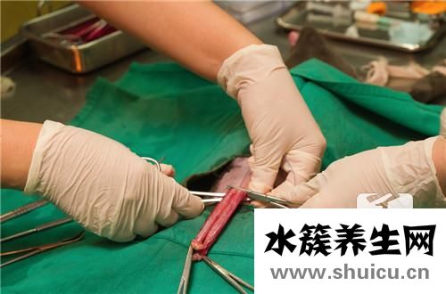帕金森手术