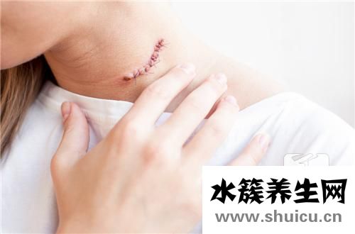 淋巴肿了回事