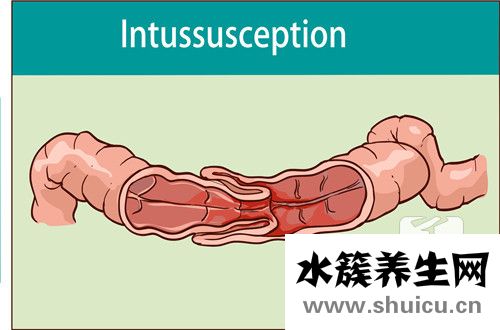 胃咕噜咕噜响