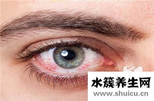 去红血丝最有效