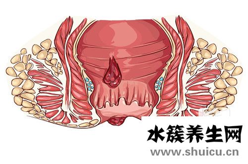 肛门上张的疙瘩是什么？肛门上长的什么疙瘩？