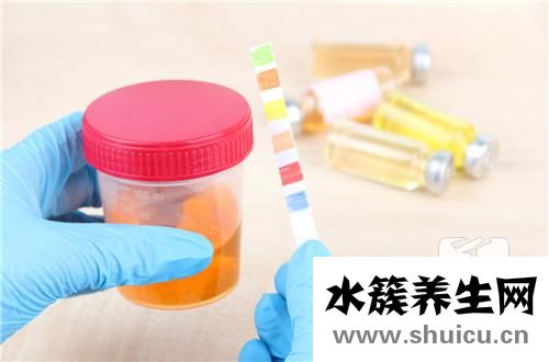 尿细菌培养