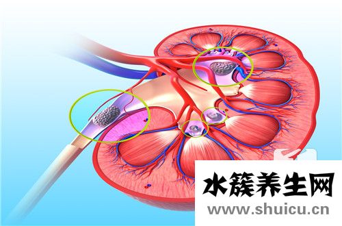 肾小球基底膜