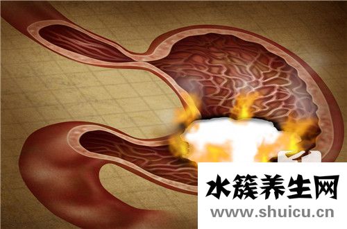 胃炎会传染吗