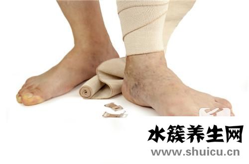 下肢血管彩超