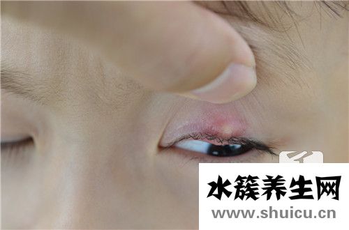 眼睛囊肿