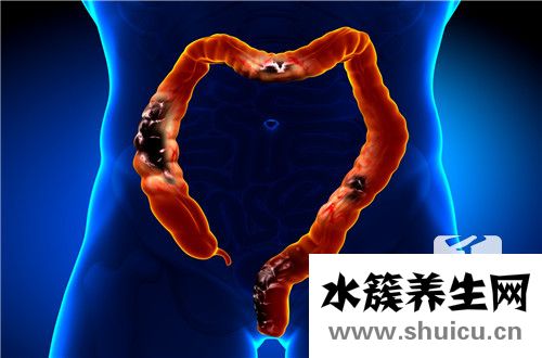 结肠有哪些症状