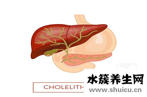 胆囊炎治疗