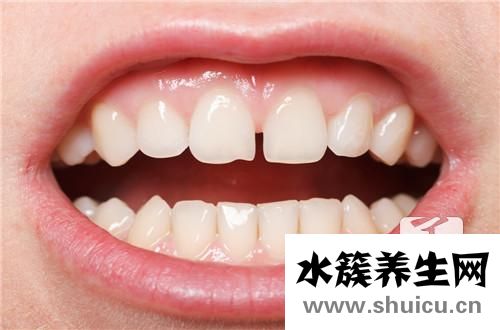 牙齿敏感疼痛办