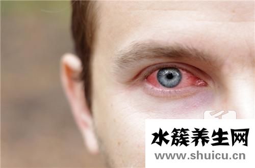 疱疹性结膜炎