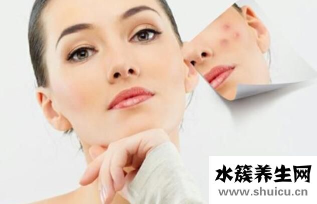 怎么快速消除痘印？推荐九个简单又有效的方法