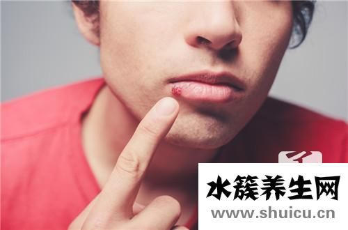 嘴唇裂口
