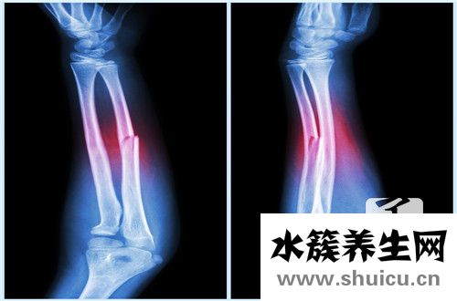 右侧髂骨疼是什么原因_ 髂骨疼痛是什么原因