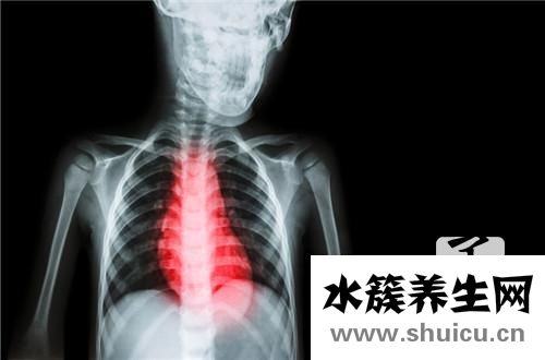 心肌坏死能治好吗