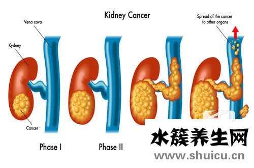 尿检正常能排除肾病吗？尿检能查肾病吗