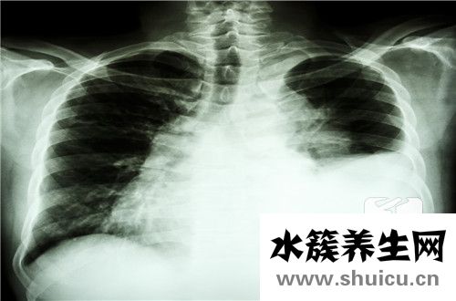 胸口痒