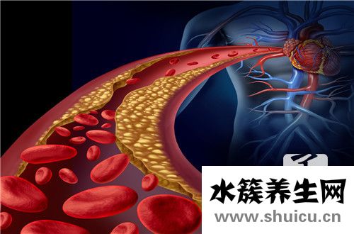 动脉硬化有斑块怎么办？如何控制动脉硬化斑块？