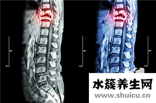 腰椎骨疼