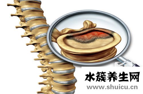 腰部上面一点脊椎骨疼 腰上面一点点的脊椎骨很痛